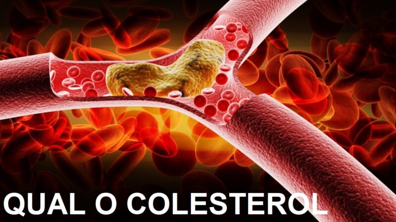 QUAL É O COLESTEROL BOM E O RUIM (HDL OU LDL) SAIBA QUAL AUMENTAR E QUAL DIMINUIR